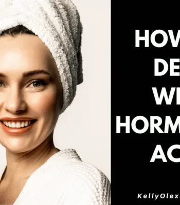 Dealing with hormonal acne